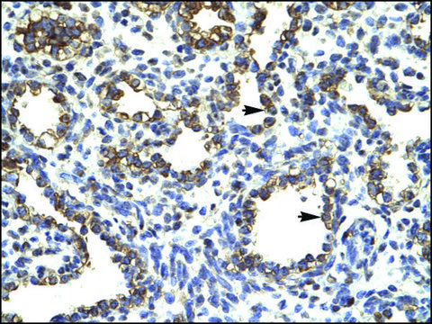 Anti-SOX5 affinity isolated antibody