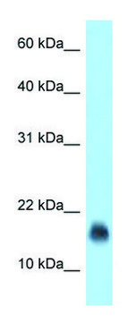 Anti-JCHAIN (N-terminal) antibody produced in rabbit affinity isolated antibody