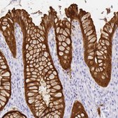Anti-LGALS4 antibody produced in rabbit Prestige Antibodies® Powered by Atlas Antibodies, affinity isolated antibody, buffered aqueous glycerol solution