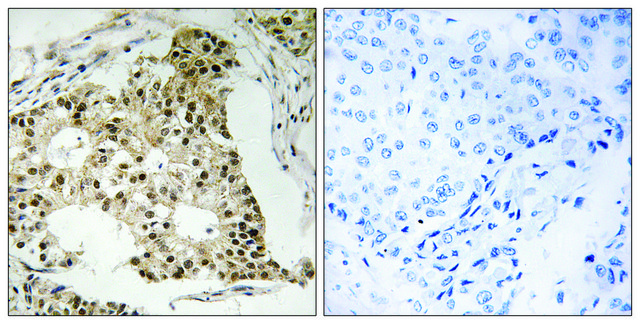 Anti-Retinoic Acid Receptor A (Phospho-SER77) affinity isolated antibody