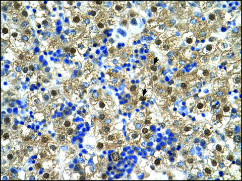 Anti-CTPS (AB1) antibody produced in rabbit IgG fraction of antiserum