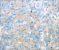Anti-UCP2 affinity isolated antibody