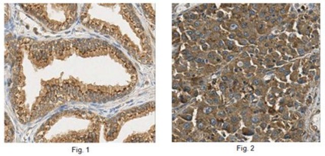 Anti-ST6GAL1 Antibody from rabbit, purified by affinity chromatography