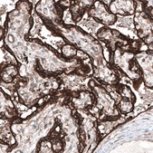Monoclonal Anti-CLIP1 antibody produced in mouse Prestige Antibodies® Powered by Atlas Antibodies, clone CL4851, purified immunoglobulin, buffered aqueous glycerol solution