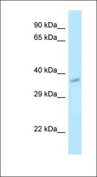 Anti-PNCK antibody produced in rabbit affinity isolated antibody