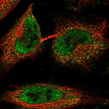 Anti-C1orf216 antibody produced in rabbit Prestige Antibodies&#174; Powered by Atlas Antibodies, affinity isolated antibody