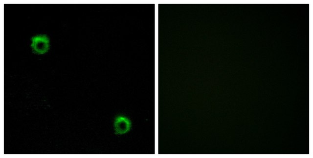 Anti-FZD2 antibody produced in rabbit affinity isolated antibody