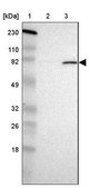 Anti-POMT2 antibody produced in rabbit Prestige Antibodies® Powered by Atlas Antibodies, affinity isolated antibody, buffered aqueous glycerol solution
