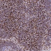 Anti-RB1 antibody produced in rabbit Prestige Antibodies® Powered by Atlas Antibodies, affinity isolated antibody, buffered aqueous glycerol solution