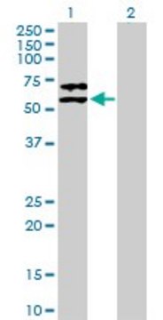 Anti-SERPINF2 antibody produced in mouse purified immunoglobulin, buffered aqueous solution