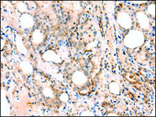 Anti-EPHB4 affinity isolated antibody