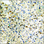 Anti-phospho-p130 Cas (pTyr410) antibody produced in rabbit affinity isolated antibody
