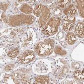 Anti-STAT5A antibody produced in rabbit Prestige Antibodies® Powered by Atlas Antibodies, affinity isolated antibody, buffered aqueous glycerol solution