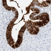 Anti-SCGB2A1 antibody produced in rabbit Prestige Antibodies® Powered by Atlas Antibodies, affinity isolated antibody, buffered aqueous glycerol solution