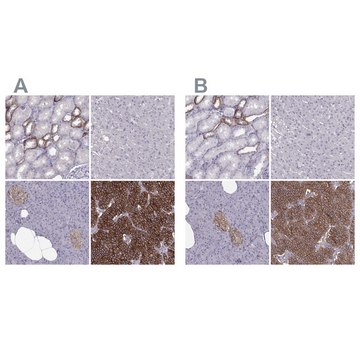 Anti-CASR antibody produced in rabbit Prestige Antibodies&#174; Powered by Atlas Antibodies, affinity isolated antibody, buffered aqueous glycerol solution