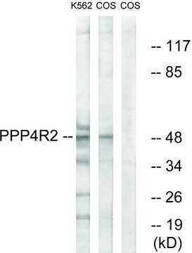 Anti-PPP4R2 antibody produced in rabbit affinity isolated antibody