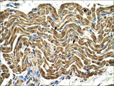 Anti-ATP5B (AB2) antibody produced in rabbit IgG fraction of antiserum