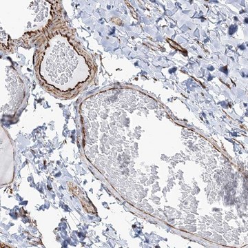 Anti-SCLT1 antibody produced in rabbit Prestige Antibodies&#174; Powered by Atlas Antibodies, affinity isolated antibody, buffered aqueous glycerol solution