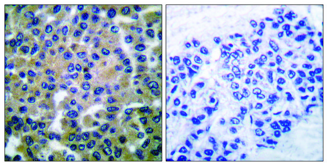 Anti-SYK antibody produced in rabbit affinity isolated antibody