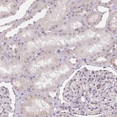 Anti-SGF29 antibody produced in rabbit Prestige Antibodies® Powered by Atlas Antibodies, affinity isolated antibody, buffered aqueous glycerol solution