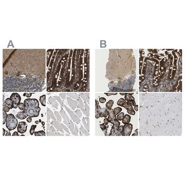 Anti-PICALM antibody produced in rabbit Prestige Antibodies&#174; Powered by Atlas Antibodies, affinity isolated antibody, buffered aqueous glycerol solution, Ab1