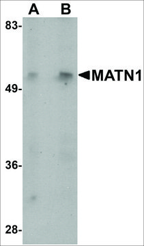 Anti-MATN1 antibody produced in rabbit affinity isolated antibody, buffered aqueous solution, ab2