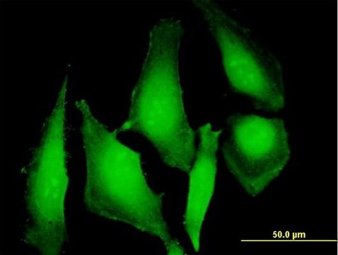 Anti-UBD antibody produced in mouse purified immunoglobulin, buffered aqueous solution