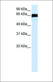 Anti-PLK1 affinity isolated antibody