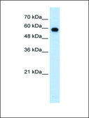 Anti-SMARCD2 antibody produced in rabbit affinity isolated antibody