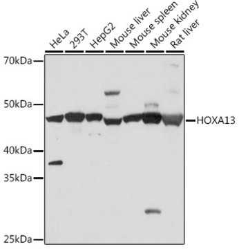 Anti-HOXA13 Antibody, clone 5K0D5, Rabbit Monoclonal