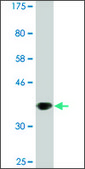 Monoclonal Anti-EDAR antibody produced in mouse clone 3A7, ascites fluid