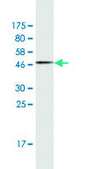 Monoclonal Anti-RRM1 antibody produced in mouse clone 1D6, purified immunoglobulin, buffered aqueous solution
