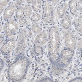Anti-CRNN antibody produced in rabbit Prestige Antibodies® Powered by Atlas Antibodies, affinity isolated antibody, buffered aqueous glycerol solution