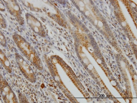 Monoclonal Anti-GMPS antibody produced in mouse clone 1D10, purified immunoglobulin, buffered aqueous solution