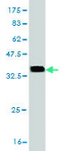 Monoclonal Anti-CDK4, (C-terminal) antibody produced in mouse clone 2G7, purified immunoglobulin, buffered aqueous solution