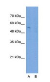 Anti-SLC22A7 (AB2) antibody produced in rabbit IgG fraction of antiserum