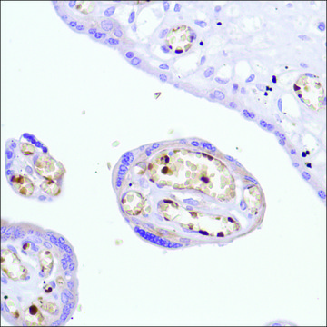 Anti-Haemoglobin Alpha Chain antibody, Rabbit monoclonal clone SP212, recombinant, expressed in proprietary host, affinity isolated antibody