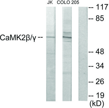 Anti-CAMK2, C-Terminal antibody produced in rabbit affinity isolated antibody