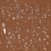 Anti-WDR41 antibody produced in rabbit Prestige Antibodies® Powered by Atlas Antibodies, affinity isolated antibody, buffered aqueous glycerol solution