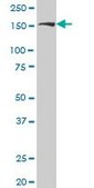 Monoclonal Anti-ROCK2, (C-terminal) antibody produced in mouse clone 1E12, purified immunoglobulin, buffered aqueous solution