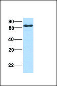Anti-ZDHHC17 (AB1) antibody produced in rabbit affinity isolated antibody