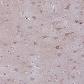 Anti-AHCYL2 antibody produced in rabbit Prestige Antibodies® Powered by Atlas Antibodies, affinity isolated antibody, buffered aqueous glycerol solution