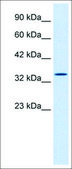 Anti-HHEX antibody produced in rabbit affinity isolated antibody