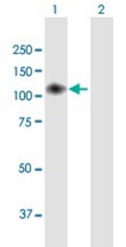 Anti-ENPP2 antibody produced in mouse purified immunoglobulin