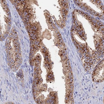 Anti-ARL16 antibody produced in rabbit Prestige Antibodies&#174; Powered by Atlas Antibodies, affinity isolated antibody, buffered aqueous glycerol solution