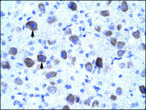 Anti-KCNIP4 antibody produced in rabbit affinity isolated antibody