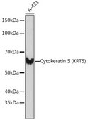 Anti-Cytokeratin 5 (KRT5) Antibody, clone 3P3T9, Rabbit Monoclonal