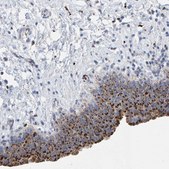 Anti-BIN3 antibody produced in rabbit Prestige Antibodies® Powered by Atlas Antibodies, affinity isolated antibody, buffered aqueous glycerol solution