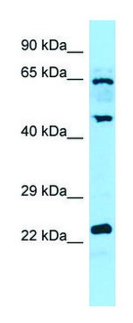 Anti-DUSP14 (C-terminal) antibody produced in rabbit affinity isolated antibody