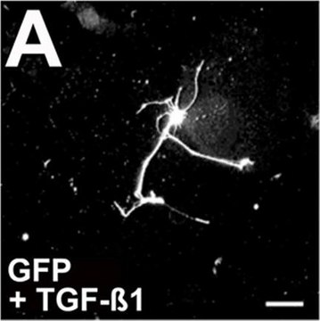 Anti-Neurofilament 200 kDa Antibody, clone RT97 clone RT97, Chemicon&#174;, from mouse